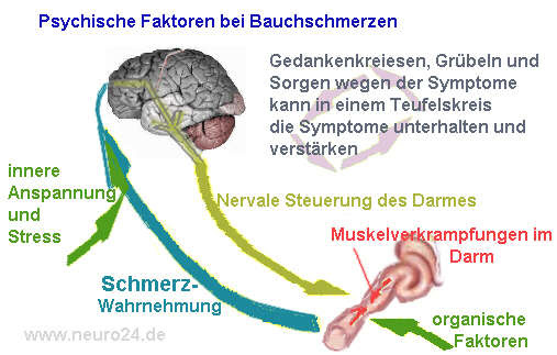 Reizdarmsyndrom