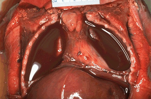 single exposure to asbestos