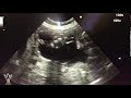 犬 妊娠 レントゲン 時期 213536-犬 妊娠 レントゲン 時期
