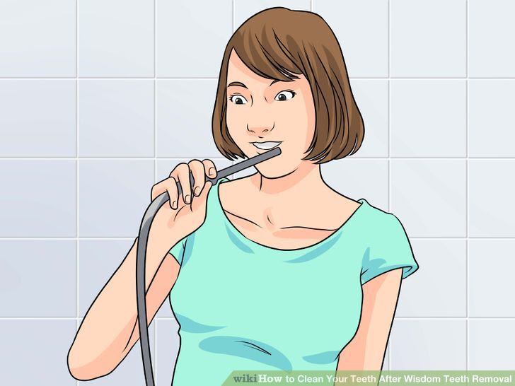 Clean Your Teeth After Wisdom Teeth Removal Step 8 Version 2.jpg