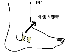 足関節捻挫