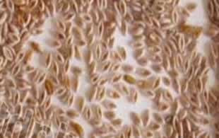 psyllium seeds
