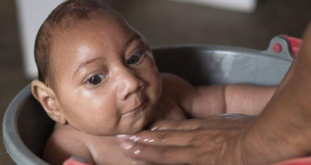 Alarmi, virusi Zika mbërrin në Europë