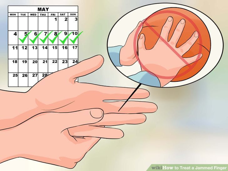 Treat a Jammed Finger Step 2 Version 2.jpg