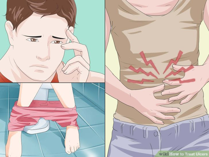 Treat Ulcers Step 1 Version 3.jpg