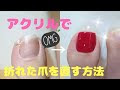 最高のコレクション スカルプ画像 171764-ネイル スカルプ画像