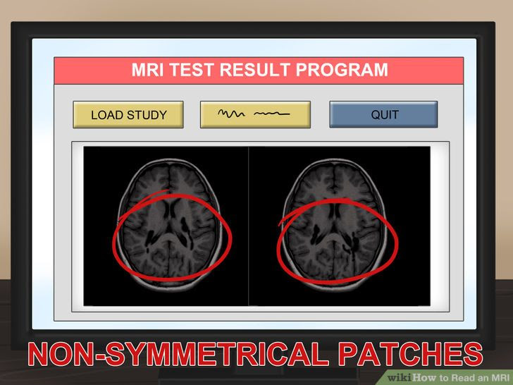 Read an MRI Step 11.jpg