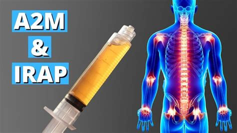 Hot hm anal bbc painal a2m mp4