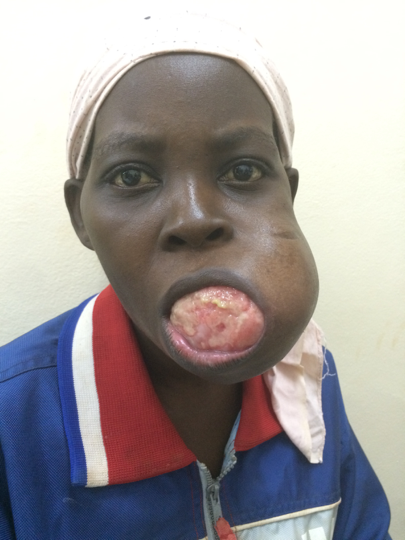 Humanitaire Fondation Bertrand Jaques