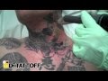 Tattoo Removal Orlando : Tattoo Removal Orlando Fl The Institute Of Aesthetic Surgery / Maybe you would like to learn more about one of these?