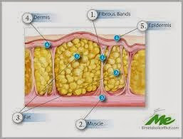 Get Rid Of Cellulite On Legs