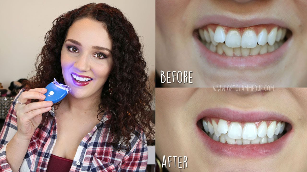 Smile bright teeth whitening kit