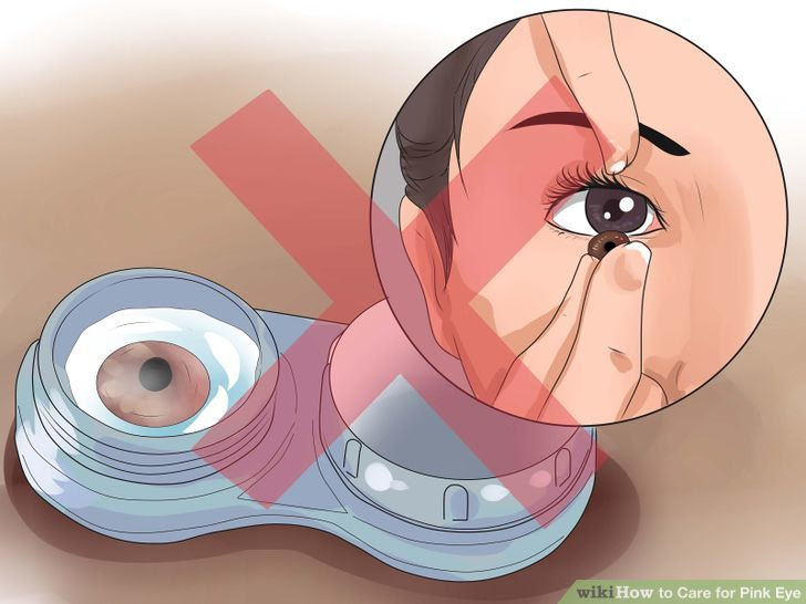 Care for Pink Eye Step 5 Version 2.jpg