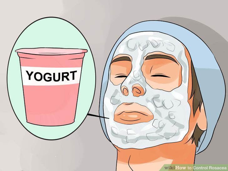 Control Rosacea Step 12 Version 2.jpg