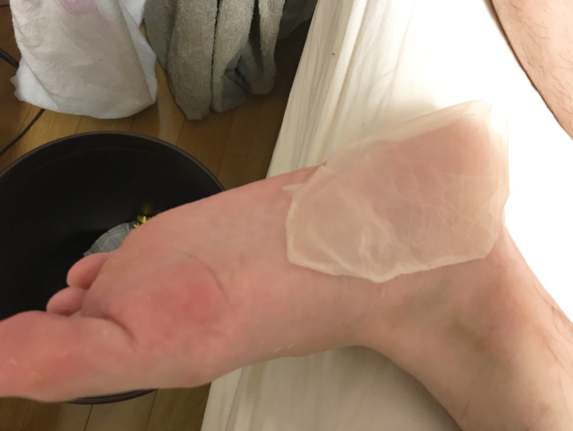 角質ズル剥けで話題沸騰 Baby Foot使ってみたら足裏脱皮した 笑 Erin Official Blog