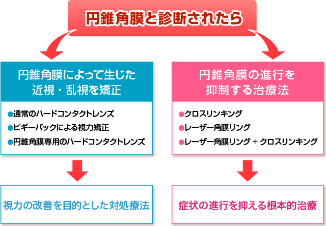 レーザー角膜リング 銀座の眼科 冨田実アイクリニック銀座