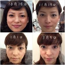 即効で顔やせできるダイエットまとめ Habari