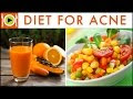 Acne Diet Food Recipes