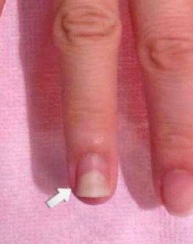 爪の白い部分が増えたら要注意