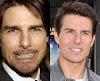 Tom Cruise Teeth