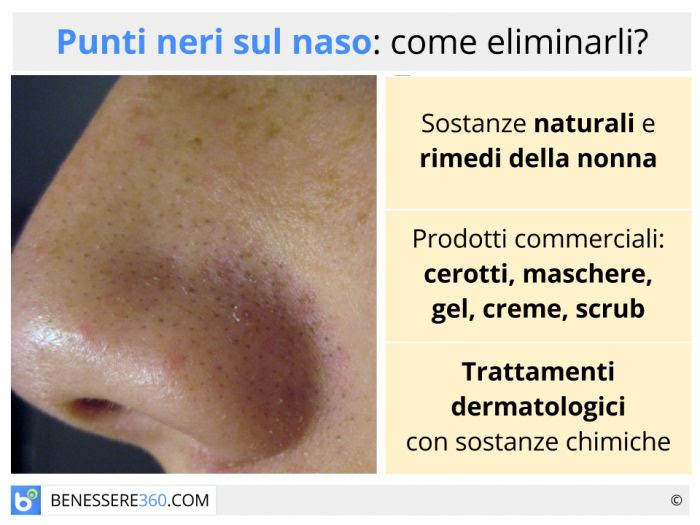 Punti neri eliminare