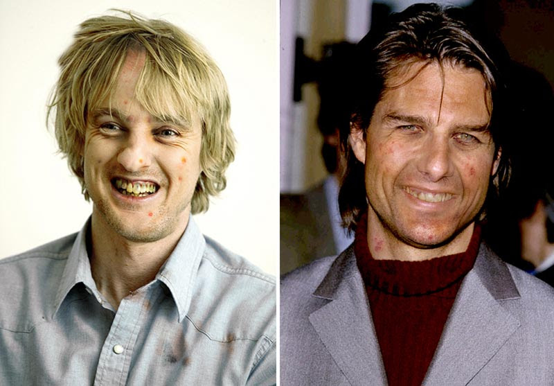 tom cruise teeth. Wilson and Tom Cruise look