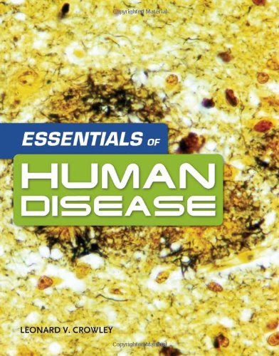 Essentials Of Human DiseaseBy Leonard Crowley