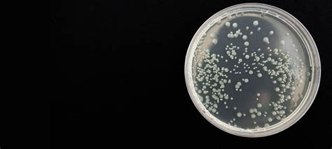 bacteria cells transformed   microscopic data recorder