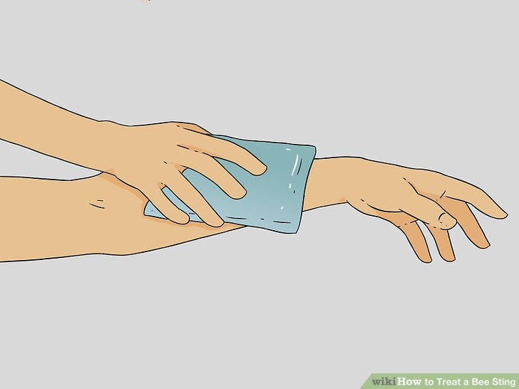Treat a Bee Sting Step 5 Version 3.jpg