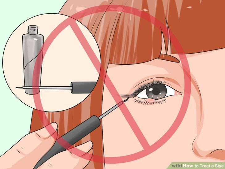 Treat a Stye Step 8 Version 2.jpg