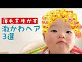 赤ちゃん 髪の毛 薄い 9ヶ�� 192243-赤ちゃん 髪の毛 薄��� 9ヶ月