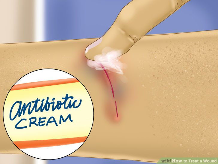 Treat a Wound Step 3 Version 2.jpg