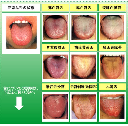 舌診 四診 とは