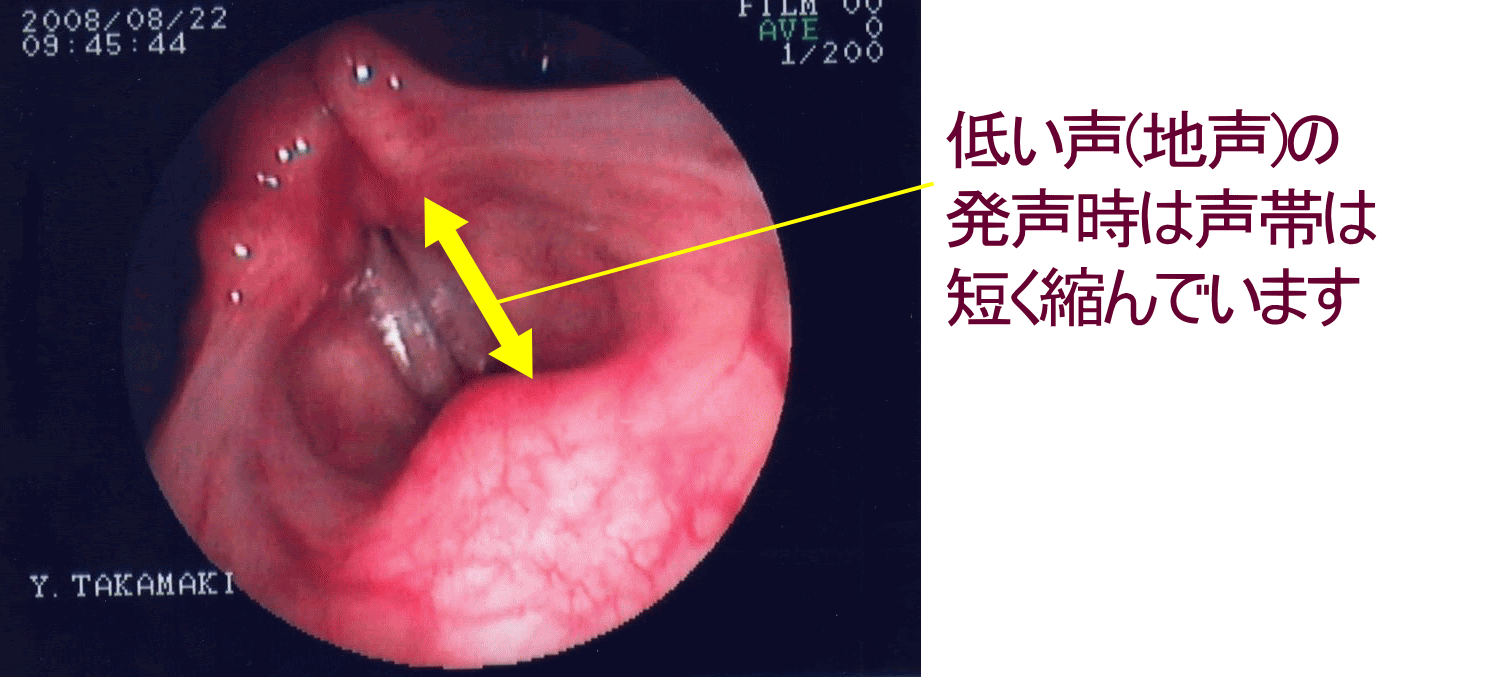 音痴の原因と直し方 音痴を治す方法 音程 リズムの合わせ方 カラオケ音痴 リズム音痴克服専門 音痴呆の直しかた ボイトレの音痴矯正専門スクール