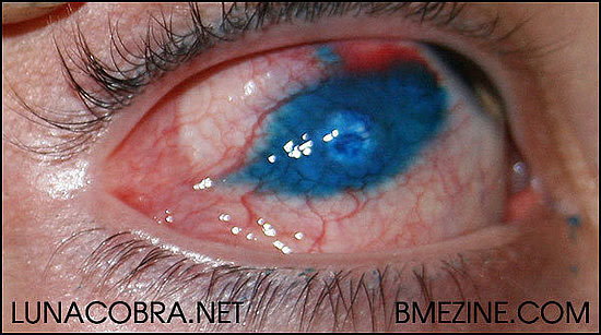 The first eye tattoo!