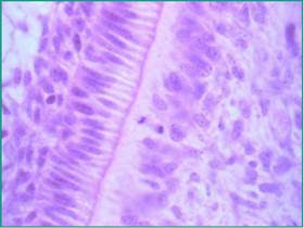 Acciones Terapeuticas Actuales En Caries Profunda Revision