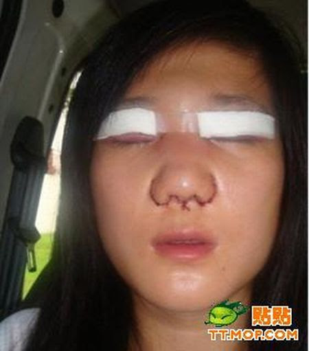 Plastic surgery is for all ages? (18 pics)