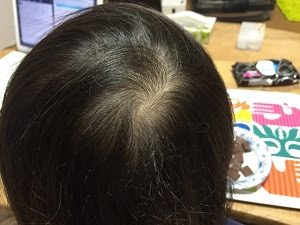 驚異の的中率９割 つむじ占いとは 第二子の赤ちゃんの性別が第一子のつむじで分かるって本当 妊娠 子育て情報局