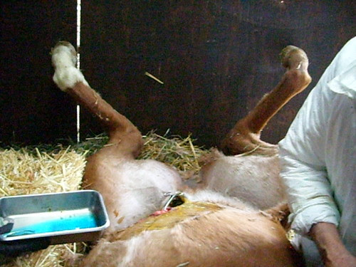 Umbilical Hernia Repair