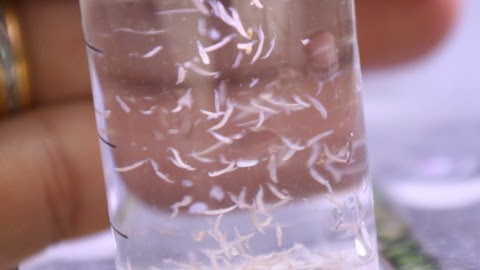 気持ちがいいほど 良く取れた寄生虫 やはり淡水浴 寄生虫 害虫について 海水魚のパイオニア 日海センター 日海フィッシュコム