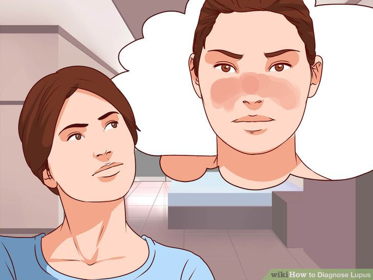 Diagnose Lupus Step 16.jpg