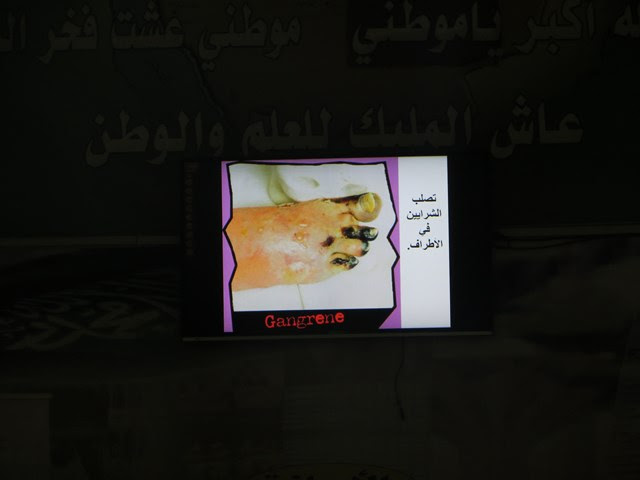 مملكتنا تدخين ثانوية الملك سعود