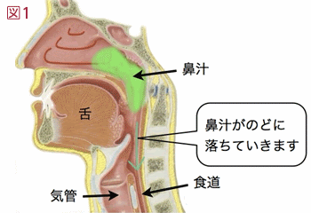 子どもがかかりやすいのどの病気 富山耳鼻咽喉科医院