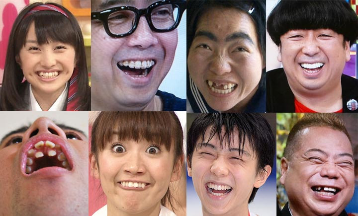 芸能人 有名人の前歯や歯並びの批評まとめ 僕の審美歯科ガイド