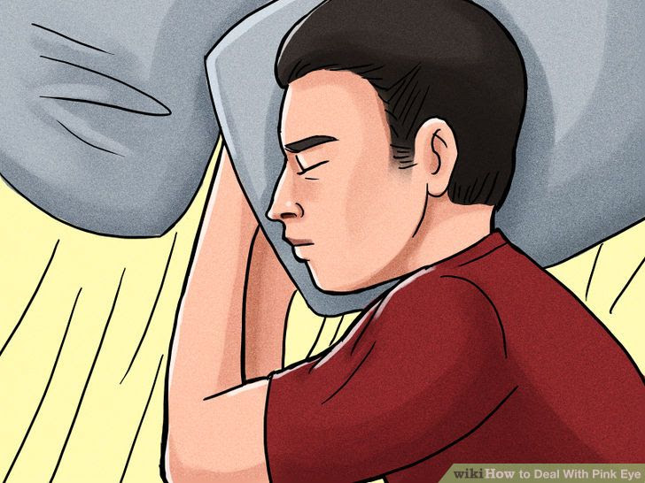 Deal With Pink Eye Step 9.jpg