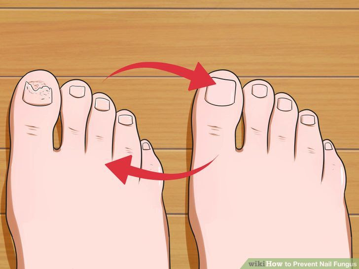 Prevent Nail Fungus Step 13.jpg