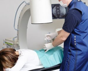 Behandlung Gereizter Nervenwurzeln Mittels Einer Periradikularen Therapie