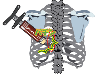 息を吸っても痛いゴルファーの背中 Tsuchikoカイロプラクティック オフィス ゴルファーズクリニック