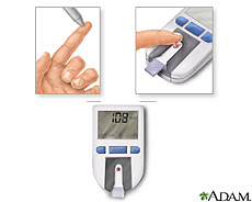 Ilustración de una prueba de sangre usando un monitor de glucosa