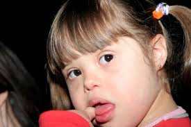 menina com sindrome de down